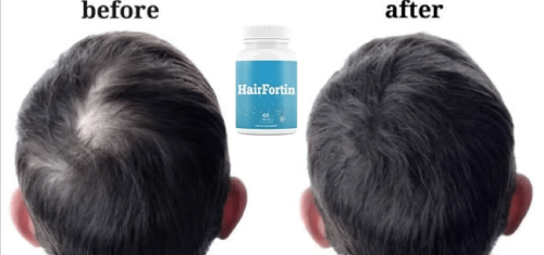 HairFortin hair growth